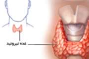 ۹۰۰ کودک بیمار کم‌کاری تیروئید در قم شناسایی‌ شده است